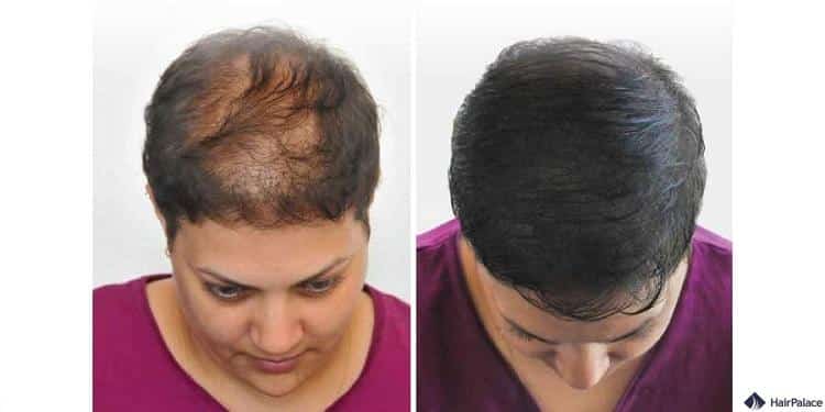 Haar Tattoo Ergebnisse für Frauen